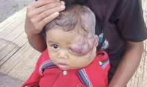 Tesiana Anur, balita berusia 10 bulan di Mera, Desa Golo Tolang, Kota Komba, mengalami sakit tumor mata. (Foto: Floresa.co)